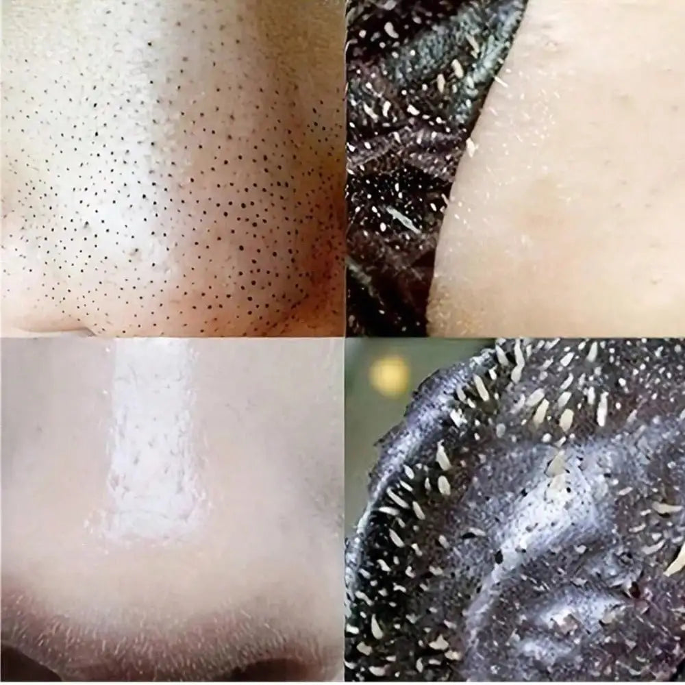 Alcohol Free Blackhead Remover Nose Strips For Deep Pore Cleansing